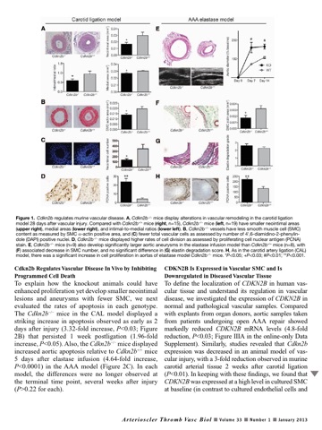 Arteriosclerosis, Thrombosis and Vascular Biology screenshot 4