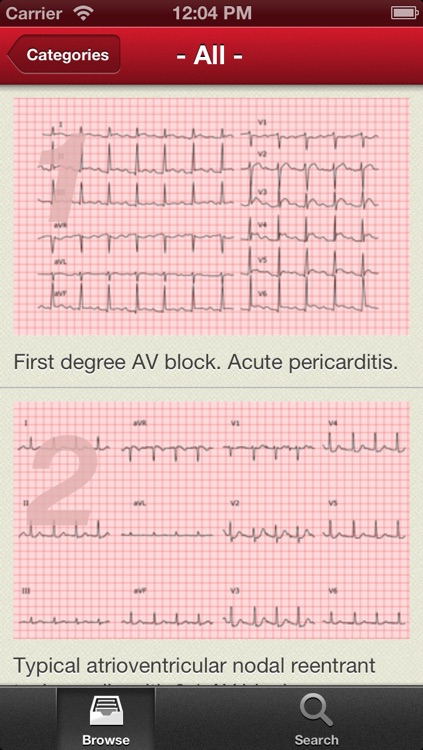 The ECG Collection