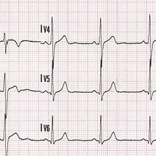 EKG Basics icon