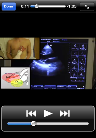 One Minute Ultrasound: Chinese screenshot 2