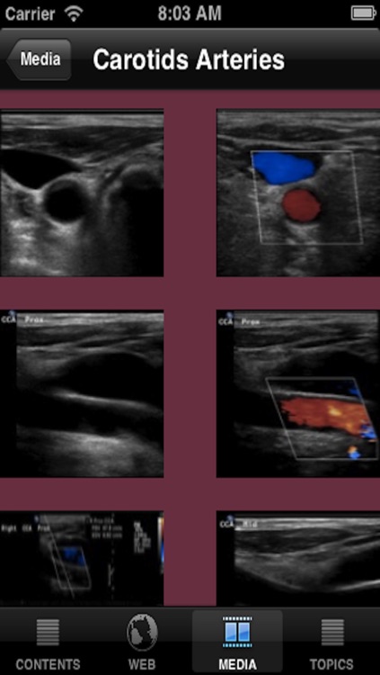 VascularLab