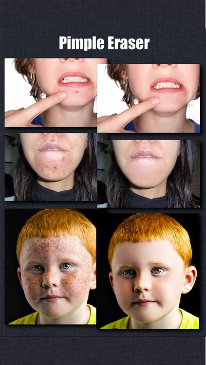 Beautify-Hair Colorizer,Pimple Eraser,Eye Colorizer screenshot-4