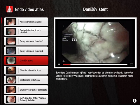 Endoskopický video atlas screenshot 3