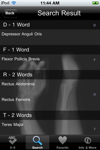 VISUAL: Muscle & Skeletal Anatomy screenshot 2