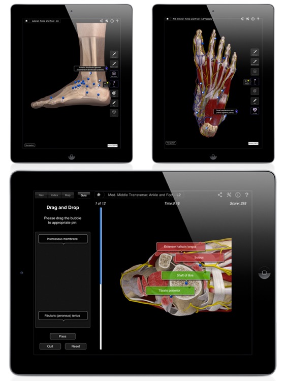 Ankle & Foot Pro III for iPad