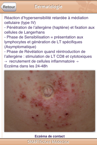 SMARTfiches Dermatologie Free screenshot 4