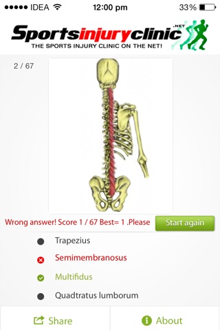 Human Muscles Quiz from Sportsinjuryclinic.net screenshot 4