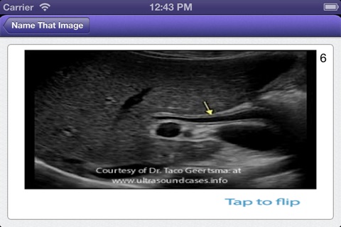 Abdominal Sonography Registry Review FlashCards screenshot 3