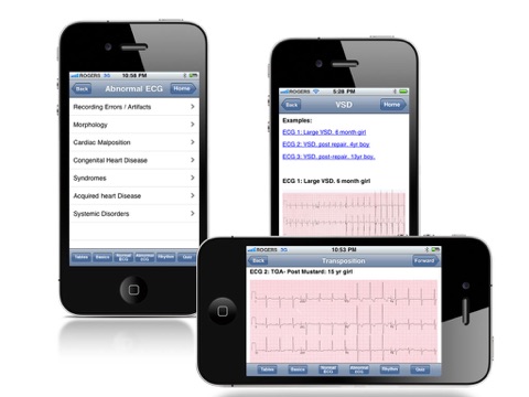 Paedcard ECG screenshot 4