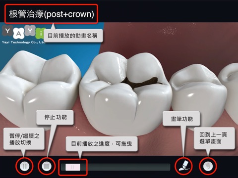E-Yayi Dental Consult (Traditional Chinese Audio Version) screenshot 4
