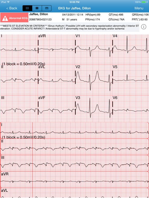 Vocera Cardiac Consult HD screenshot-3