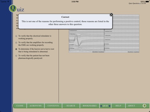 Intraoperative Neurophysiology: Interactive Case Studies by Alan D. Legatt, MD, PhD screenshot 3