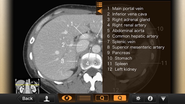 Interactive CT and MRI Anatomy(圖3)-速報App