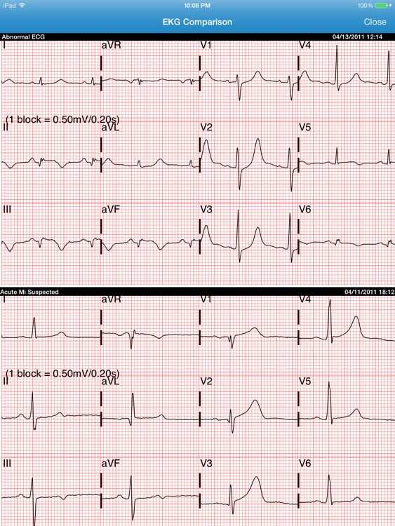 Vocera Cardiac Consult HD screenshot-4