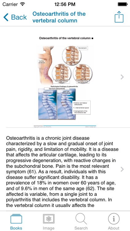 Miniatlas Diseases of the vertebral column screenshot-3