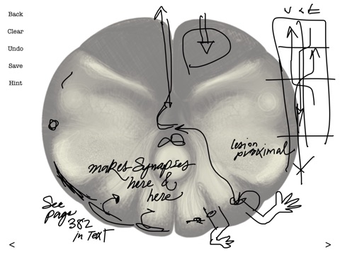 Brainstem101 - Neuroanatomy of the Human Brainstem screenshot 4