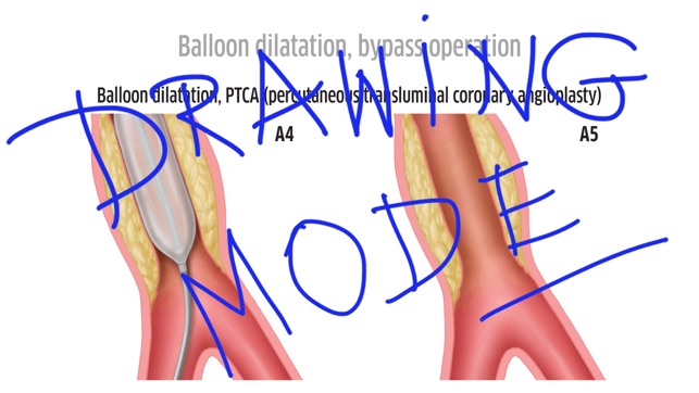 Patient Education Institute(圖4)-速報App