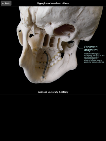 Screenshot #6 pour Skull Osteology