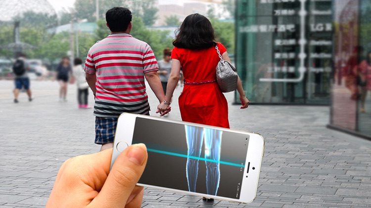 Xray Scan 2 screenshot-3