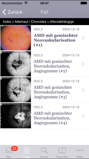 Atlas of Ophthalmology by Onjoph(圖2)-速報App