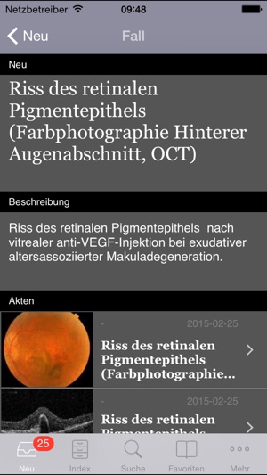 Atlas of Ophthalmology by Onjoph(圖3)-速報App