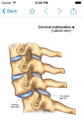 Miniatlas Musculoskeletal System screenshot 4