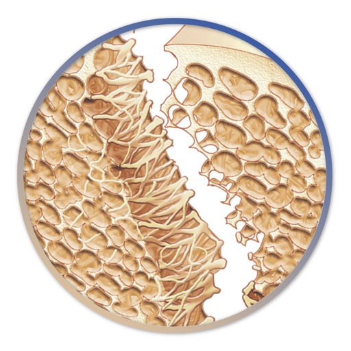 Miniatlas Osteoporosis