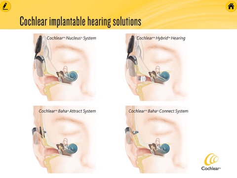 Cochlear Consult screenshot 3