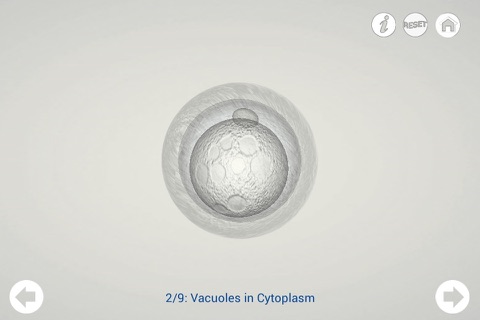 Assisted Reproduction (Free Version) screenshot 4