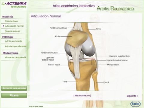 Atlas Artritis Reumatoide screenshot 4