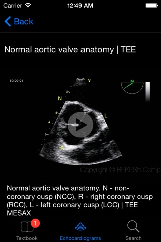 CARDIO3®Echocardiography screenshot 3