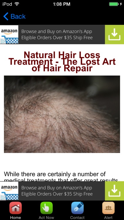 Hair Loss Treatment , Prevention and Cure