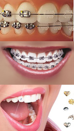 Orthodontic تقويم الاسنان(圖2)-速報App