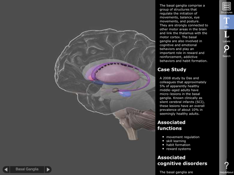 3D Brain Screenshot 3