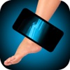 Simulator X-Ray Foot Fracture