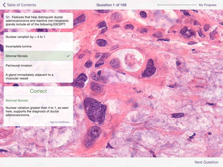 Johns Hopkins Atlas of Pancreatic Pathology screenshot-4