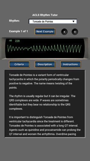 ACLS Rhythm Tutor(圖4)-速報App