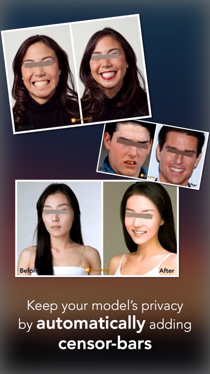 BeforeAfter Pro -The Quickest Before & After Maker screenshot-3
