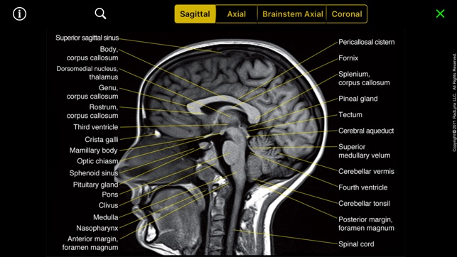 NeuroRad Mini(圖2)-速報App