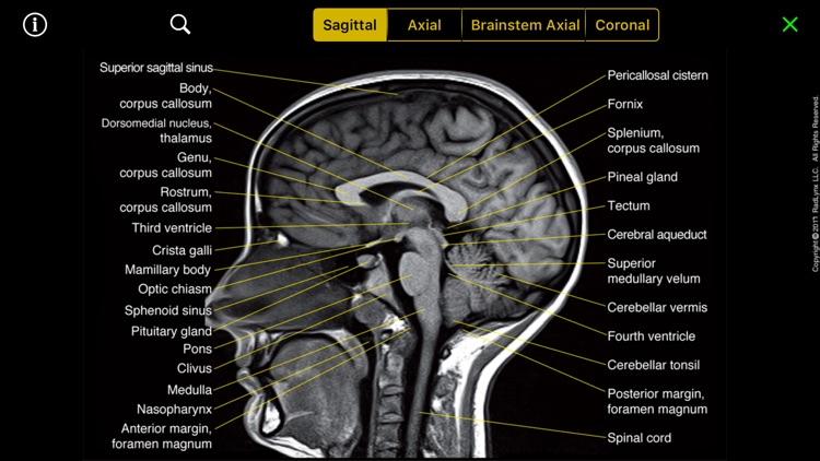 NeuroRad Mini