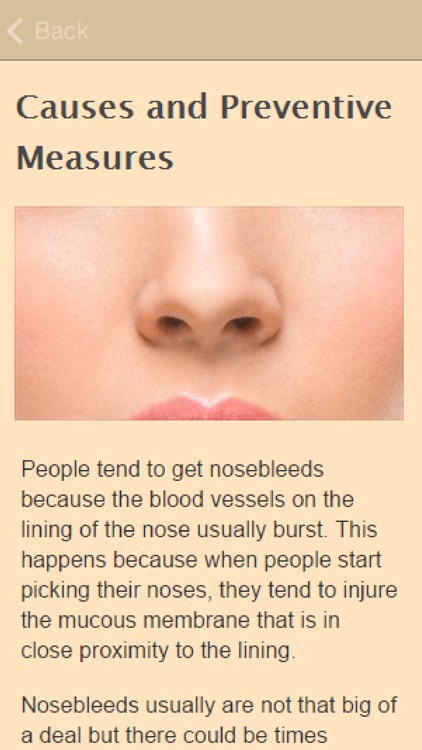 How To Stop Nosebleeds