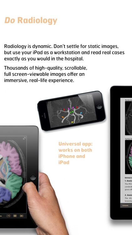 Diagnostic Radiology - Imaging in Stroke