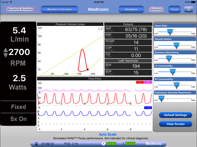 HVAD Waveforms(圖2)-速報App