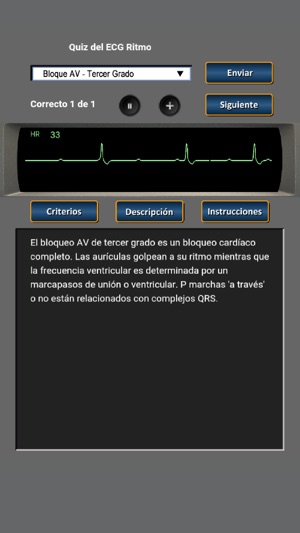 Quiz del ECG Ritmo(圖4)-速報App