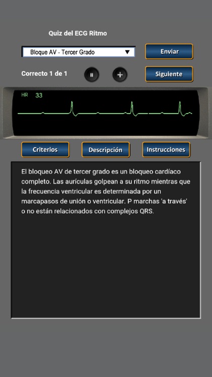 Quiz del ECG Ritmo screenshot-3