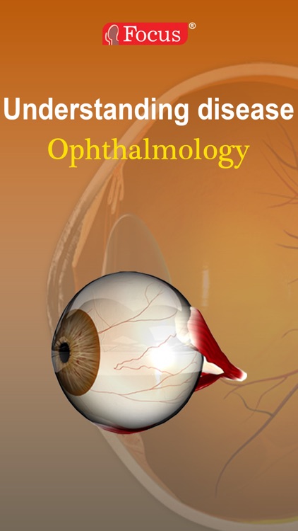 Ophthalmology - Understanding Disease