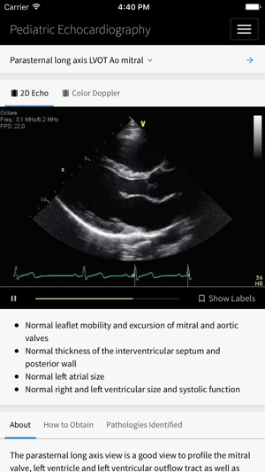 Pediatric Echocardiography(圖2)-速報App