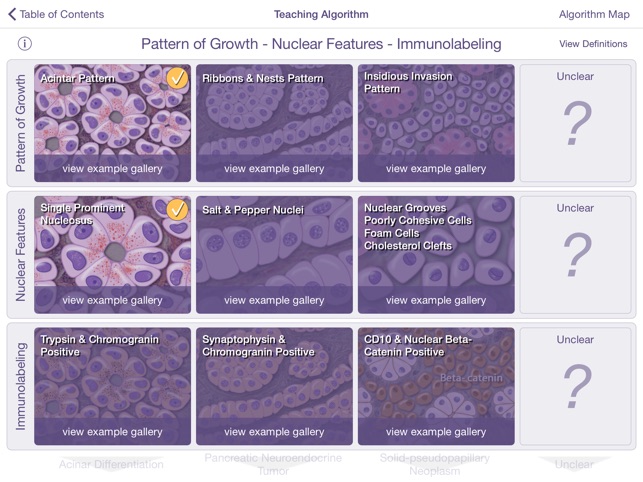 Johns Hopkins Atlas of Pancreatic Pathology(圖4)-速報App