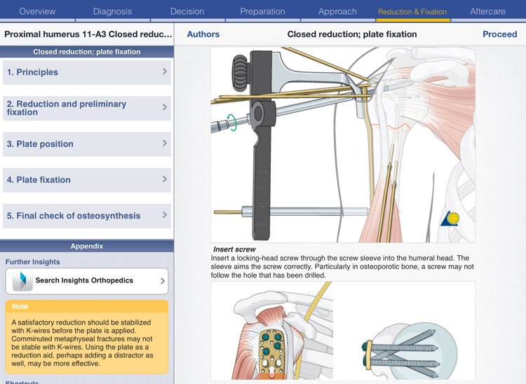 AO Surgery Reference HD screenshot-4
