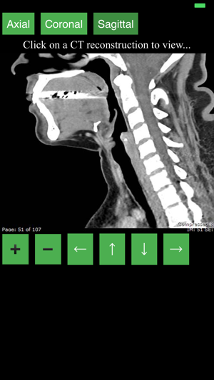 CT Neck(圖2)-速報App